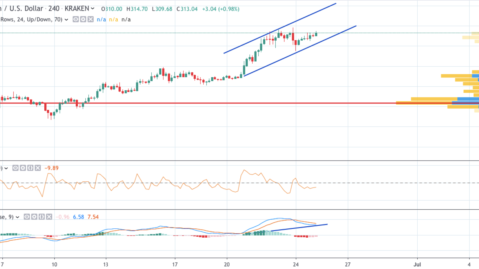 ETH/USD chart by TradingView